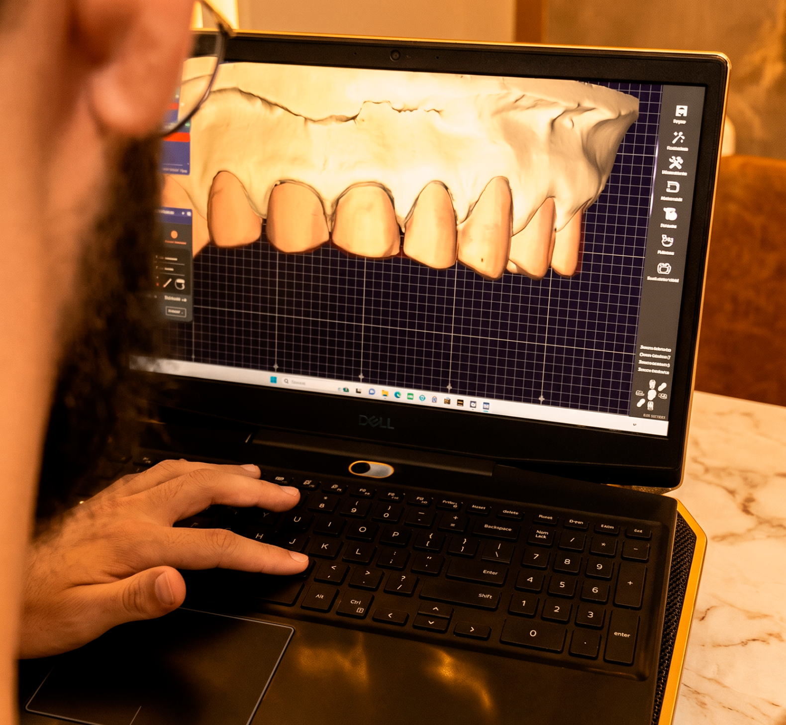 Software CAD para prótese dentária